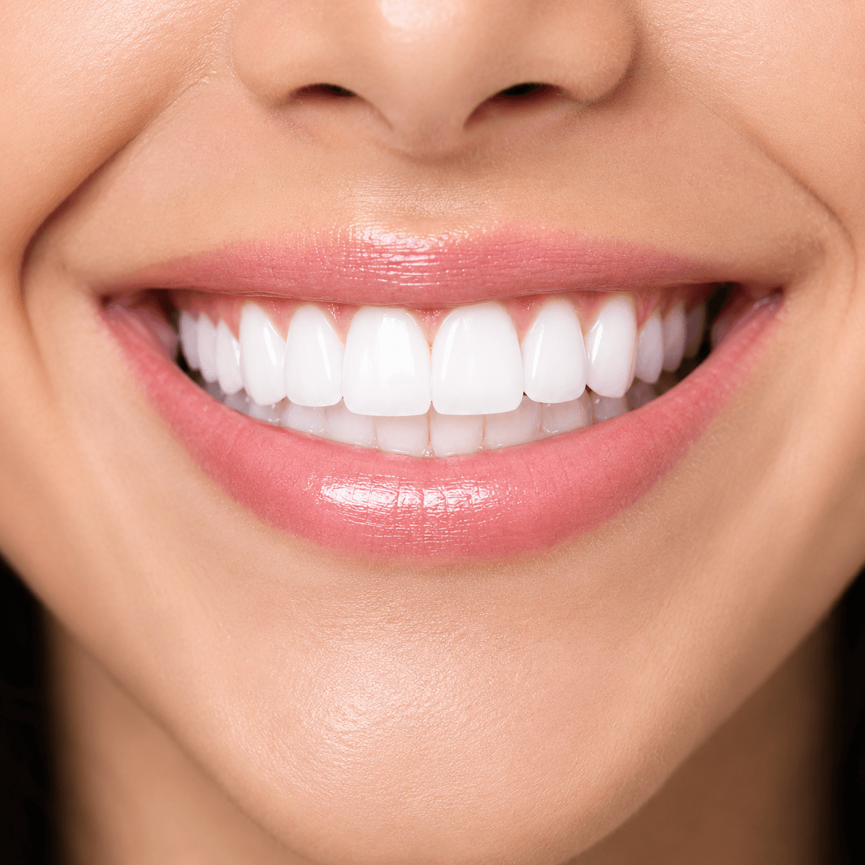 Smile Designing